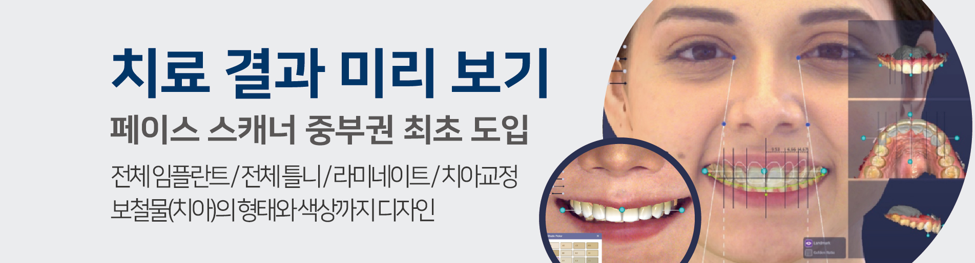 SUN DENTAL HOSPITAL 선치과병원은 최고의 의료진과 최첨단 장비를 통해 여러분의 아름다운 미소와 건강한 치아를 지켜드립니다.