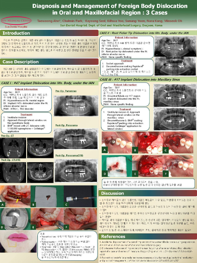 2018 춘계 포스터@.jpg