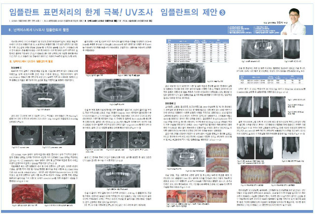 임플란트의 제안.JPG